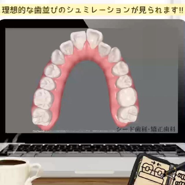 #歯科矯正 #シード歯科　#矯正

こんにちは☺︎
シード歯科・矯正歯科です

当院が取り入れております、マウスピース矯正の
「インビザライン」では治療開始前に理想的な歯並びへのシュミレーションを実際に見ていただき、患者様にご納得いただけるよう丁寧なカウンセリング行っております。

ぜひお気軽にご相談いただければと思います😌

治療費
セラミックインレー2.2万円〜
セラミッククラウン6.6万円～
ラミネートベニア9.9万円〜
部分矯正、マウスピース矯正33万円〜132万円
その他再診料、処置料が1,100円〜11,000円かかります。

⚠️リスク
噛み合わせの不調、顎関節症状、歯がしみる、セラミックの脱離、チッピング等、稀に生じる場合がございます。

*****************************

⚪︎シード歯科・矯正歯科 東京
( Tel )  03-6265-1732
( mail ) miyabi.dc@gmail.com

 @seed_dental_tokyo 

*****************************

ぜひフォローよろしくお願いします✨️
@seed_dental_nanto
@seed_dental_takaoka 

#矯正歯科  #マウスピース矯正  #部分矯正  #ワイヤー矯正 
#インビザライン#歯列矯正 #審美歯科
#審美補綴
#自由診療専門 #審美歯科治療
#ホワイトニング #ジルコニア #予防歯科
#お求めやすい価格 #美しい歯 #美容歯科