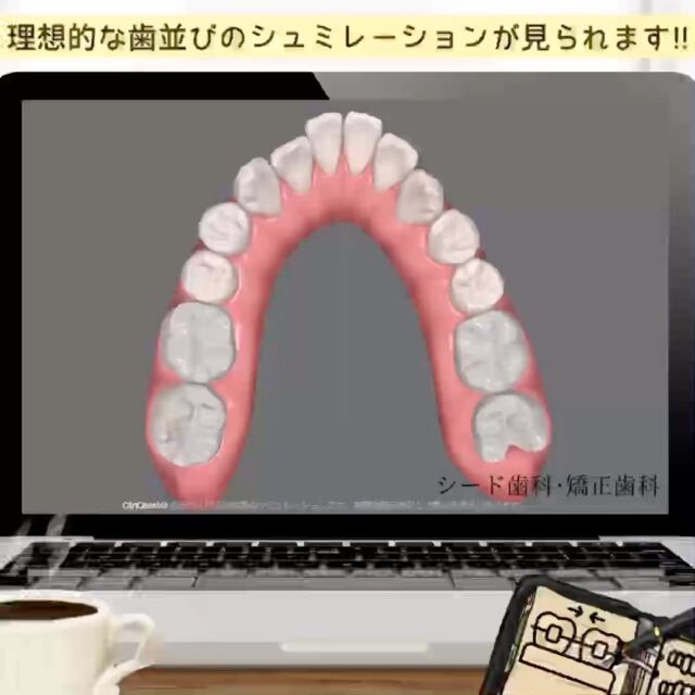 #歯科矯正 #シード歯科　#矯正

こんにちは☺︎
シード歯科・矯正歯科です

当院が取り入れております、マウスピース矯正の
「インビザライン」では治療開始前に理想的な歯並びへのシュミレーションを実際に見ていただき、患者様にご納得いただけるよう丁寧なカウンセリング行っております。

ぜひお気軽にご相談いただければと思います😌

治療費
セラミックインレー2.2万円〜
セラミッククラウン6.6万円～
ラミネートベニア9.9万円〜
部分矯正、マウスピース矯正33万円〜132万円
その他再診料、処置料が1,100円〜11,000円かかります。

⚠️リスク
噛み合わせの不調、顎関節症状、歯がしみる、セラミックの脱離、チッピング等、稀に生じる場合がございます。

*****************************

⚪︎シード歯科・矯正歯科 東京
( Tel )  03-6265-1732
( mail ) miyabi.dc@gmail.com

 @seed_dental_tokyo 

*****************************

ぜひフォローよろしくお願いします✨️
@seed_dental_nanto
@seed_dental_takaoka 

#矯正歯科  #マウスピース矯正  #部分矯正  #ワイヤー矯正 
#インビザライン#歯列矯正 #審美歯科
#審美補綴
#自由診療専門 #審美歯科治療
#ホワイトニング #ジルコニア #予防歯科
#お求めやすい価格 #美しい歯 #美容歯科